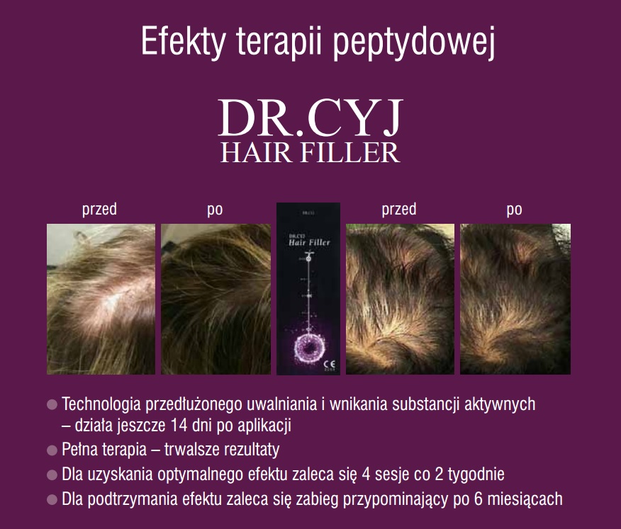 dr-cyj-efekty-dermatologiabielsko